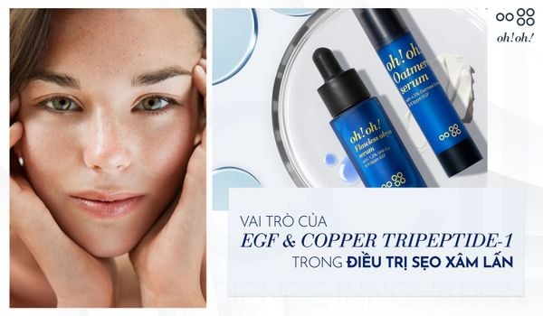 Vai Trò Của EGF & Copper Tripeptide-1 Trong Điều Trị Sẹo Xâm Lấn