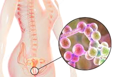 Rối loạn hệ vi sinh vật và ứng dụng của liệu pháp probiotic trong viêm âm đạo do nhiễm vi khuẩn và nhiễm nấm