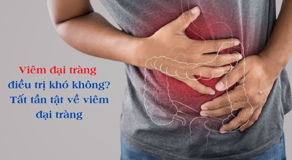 Viêm đại tràng điều trị khó không? TẤT TẦN TẬT về bệnh đại tràng