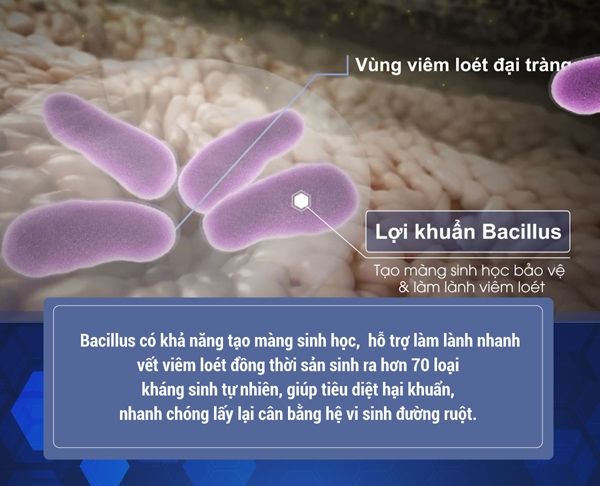 Cơ chế của bào tử lợi khuẩn COLON đối với bệnh viêm đại tràng