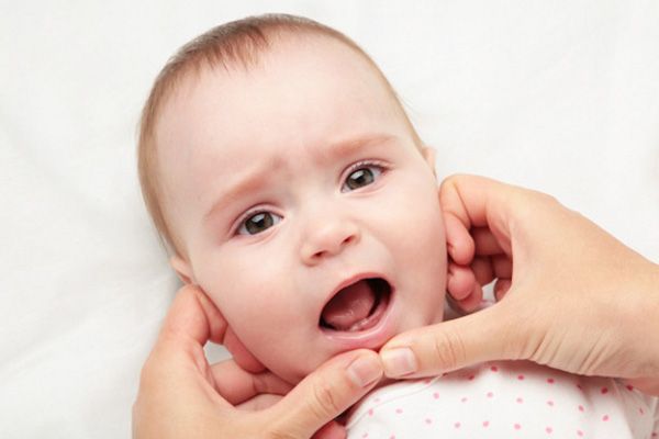 Tìm hiểu về đặc điểm và quá trình mọc răng sữa ở trẻ