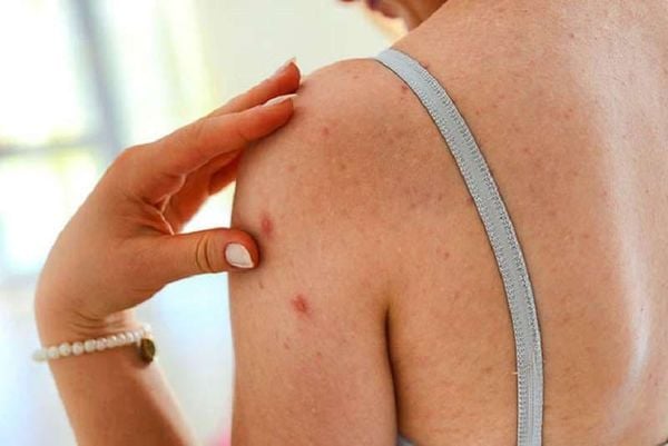 Sữa tắm trắng da cho da nhạy cảm: Lựa chọn nào an toàn?