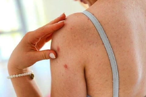 Sữa tắm trắng da cho da nhạy cảm: Lựa chọn nào an toàn?