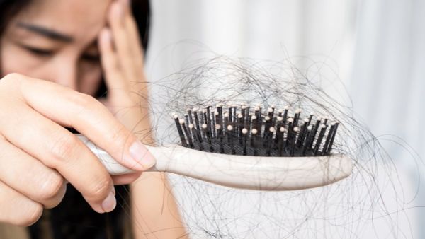 Rụng tóc là thiếu chất gì? Lời khuyên của chuyên gia giúp giảm tình trạng rụng tóc