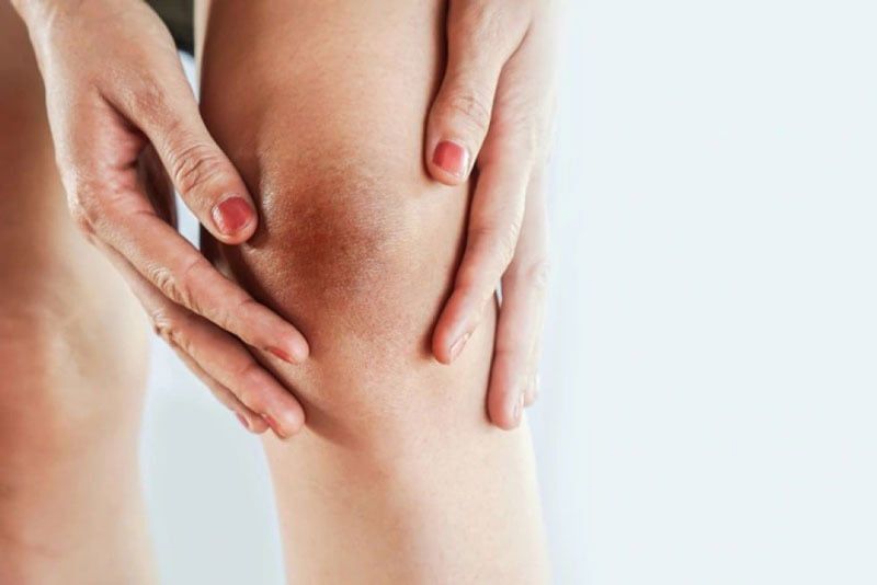 Những vùng da nào dễ bị thâm sạm trên cơ thể