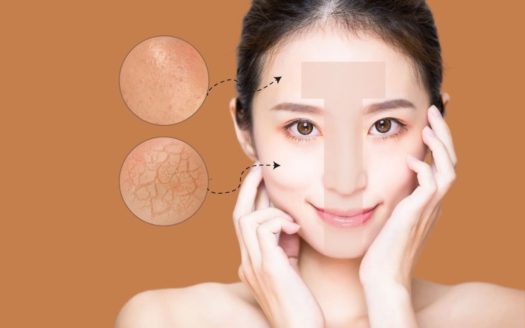 Các vấn đề da hỗn hợp dễ gặp phải