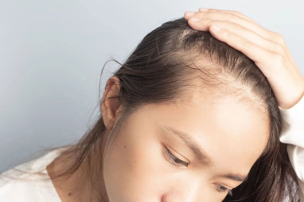 Sau sinh tóc rụng nhiều phải làm sao?