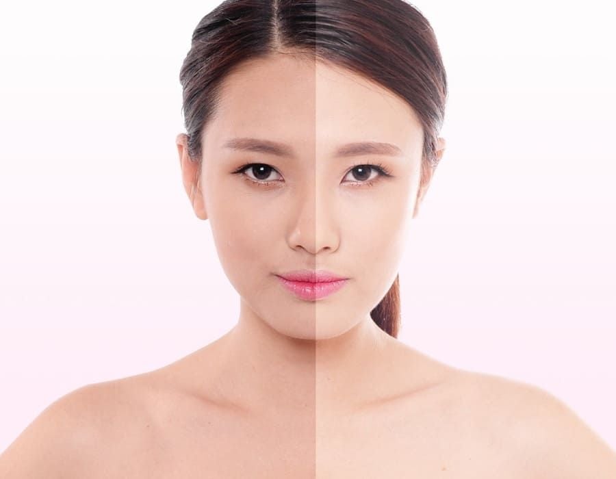 da ngăm đen có trắng lên được không