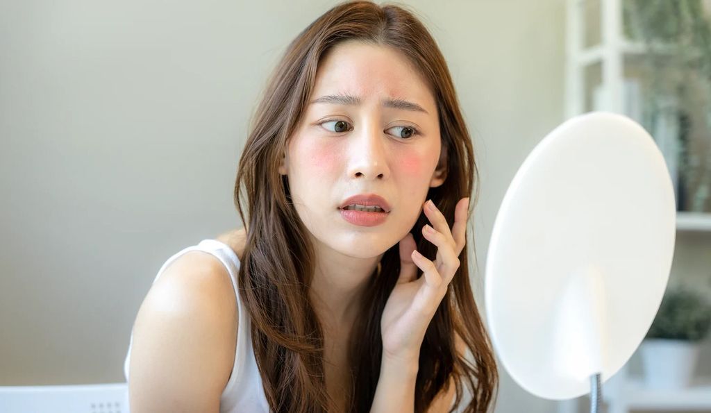 Dấu hiệu nhận biết da nhạy cảm và cách chăm sóc