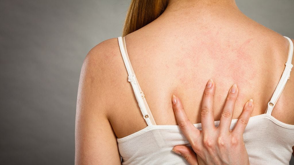 Vì sao da bị xỉn màu kém sức sống?