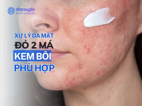 Xử Lý Mặt Bị Đỏ 2 Bên Má Tại Nhà Với Kem Bôi Thoa
