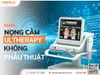 Giảm Nọng Cằm Không Phẫu Thuật Với Ultherapy