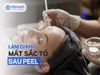 Da bị mất sắc tố sau peel - Nên làm gì?