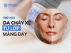Trẻ Hóa Da Chảy Xệ Từ Lớp Màng Đáy