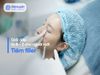 Tiêm filler là gì? Giải đáp A - Z cho người mới bắt đầu