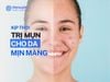 Trị Mụn Kịp Thời Cho Da Mịn Màng