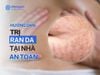 Hướng Dẫn Trị Rạn Da Tại Nhà Và Giải Pháp Công Nghệ Cao