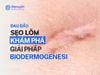 Sẹo Lõm Cứng Đầu? Khám Phá Giải Pháp Biodermogenesi