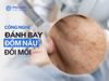 Đánh Bay Đốm Nâu Đồi Mồi: Công Nghệ Cao Hàng Đầu