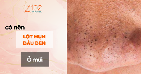 Có Nên Lột Mụn Đầu Đen Ở Mũi Không?