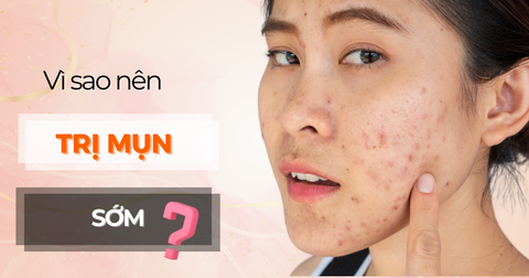 Vì sao nên điều trị mụn sớm?