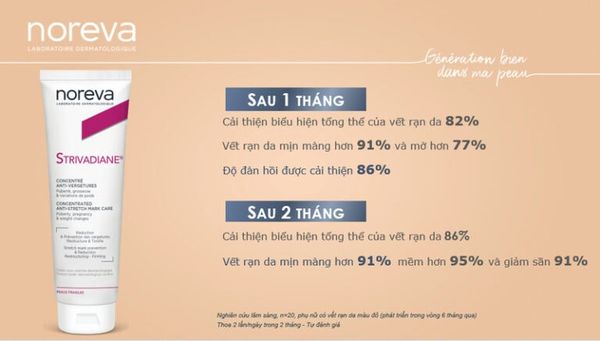 ngua-ran-da-cho-ba-bau-noreva