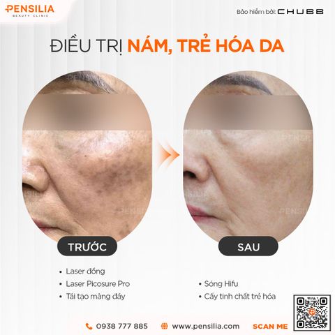 nam-hon-hop-truoc-sau