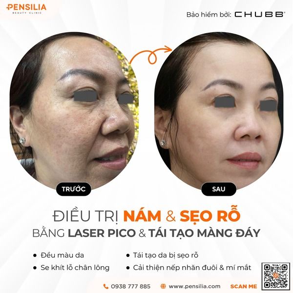 cham-soc-da-nam-truoc-sau