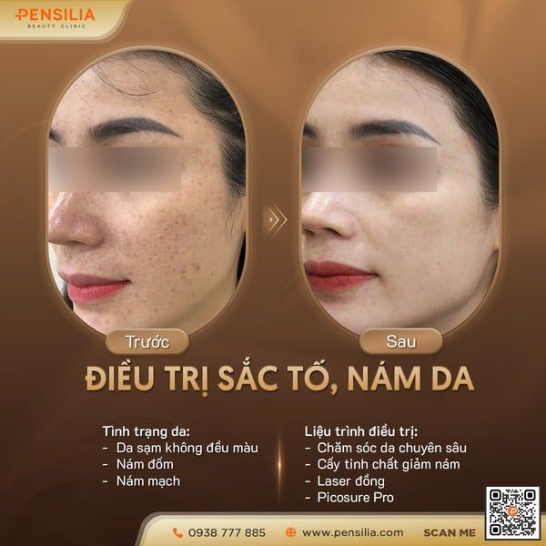 da-noi-dom-nau-meo-truoc-sau