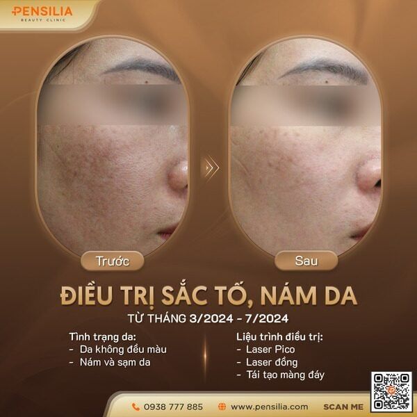 dung-retinol-nam-dam-hon-truoc-sau