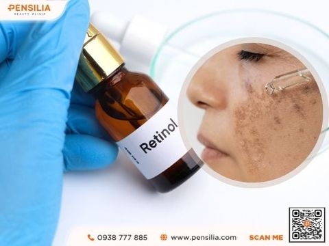 dung-retinol-nam-dam-hon