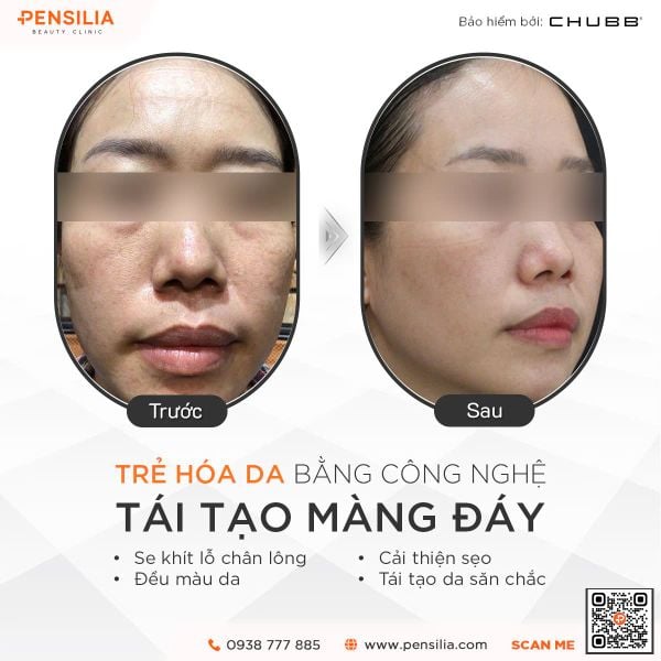 uong-collagen-truoc-sau-tre-hoa-da