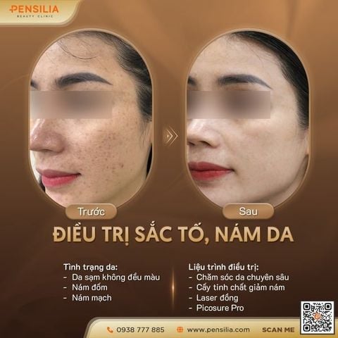 xoa-dom-nau-doi-moi-truoc-sau