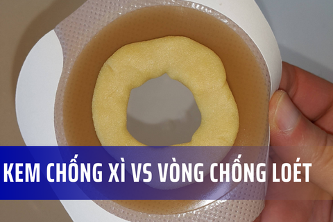 Kem chống xì và vòng chống loét dành cho hậu môn nhân tạo