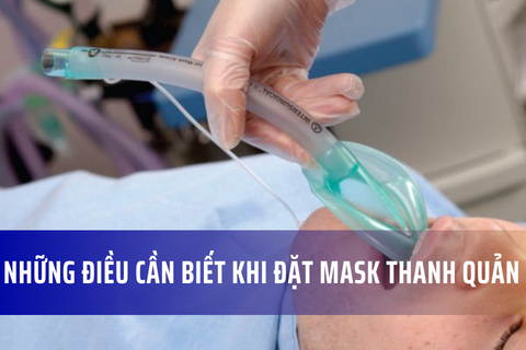 Những điều cần biết khi đặt mask thanh quản – Merinco