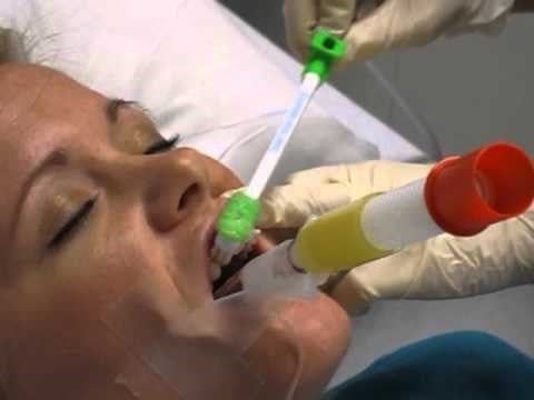 Qui trình chăm sóc răng miệng