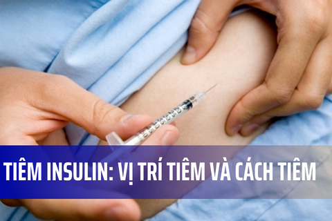 Tiêm insulin: Vị trí tiêm và cách tiêm