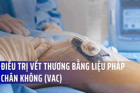 Điều trị vết thương bằng Liệu pháp chân không (VAC) – Merinco