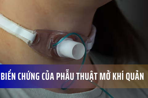 Các biến chứng và rủi ro của phẫu thuật mở khí quản