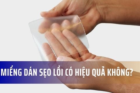 Miếng dán sẹo lồi có hiệu quả không?