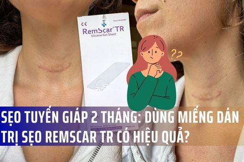 Sẹo tuyến giáp 2 tháng: Dùng miếng dán trị sẹo RemScar TR có hiệu quả?