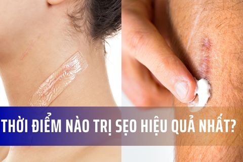 Thời điểm nào trị sẹo hiệu quả nhất?