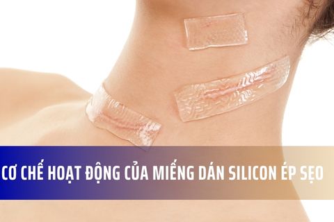 Cơ chế hoạt động của miếng dán silicon ép sẹo