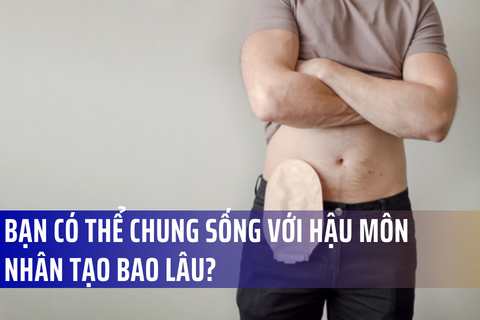 Bạn có thể chung sống với hậu môn nhân tạo trong bao lâu?