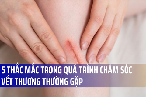 5 thắc mắc trong quá trình chăm sóc vết thương thường gặp