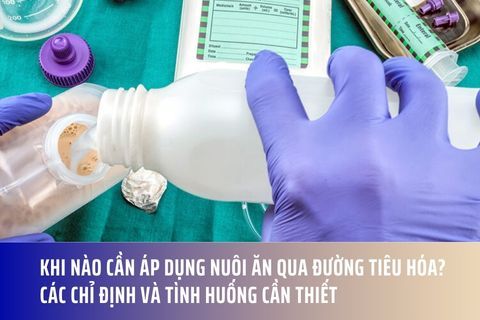 Khi nào cần áp dụng nuôi ăn qua đường tiêu hóa? Các chỉ định và tình huống cần thiết