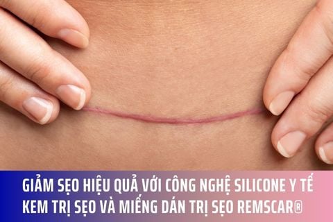 Giảm Sẹo Hiệu Quả với Công Nghệ Silicone Y Tế: Kem trị sẹo và Miếng dán trị sẹo RemScar®