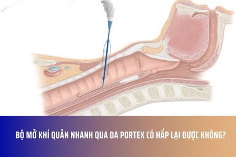 Bộ mở khí quản nhanh qua da Portex có hấp lại được không?