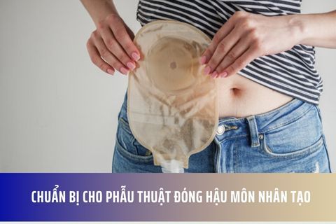 Chuẩn bị cho phẫu thuật đóng hậu môn nhân tạo