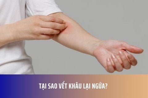 Tại Sao Vết Khâu Lại Ngứa?